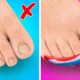 Amazing Feet Gadgets and Hacks || DIY Ideas For Your Shoes