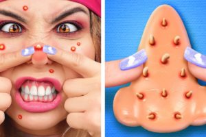 Don’t touch the PIMPLES *Amazing GADGETS from Tik Tok*